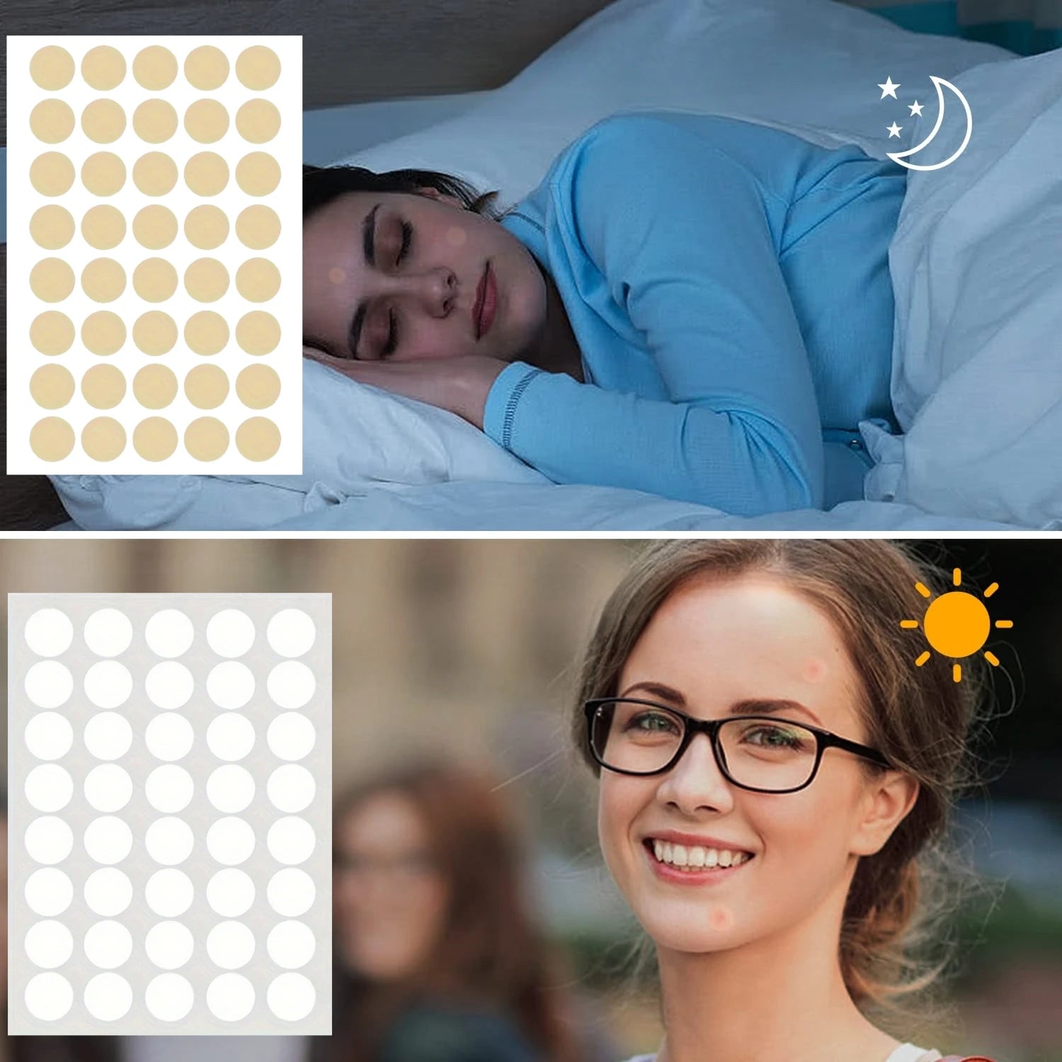 400pcs Acne Patch, Covers Pimple And Acne, Pimple Patch for Covering Zits And Blemishes, Spot Stickers for Face And Skin